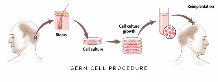 Germ Cell Procedure 1