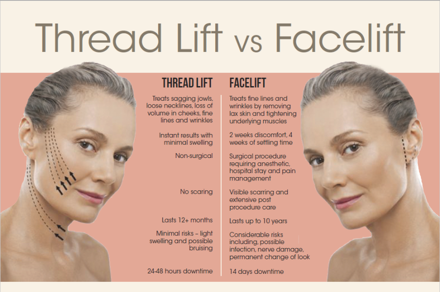 compare face and thread lift reviews